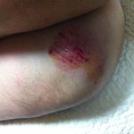 아버지께서 인적이드문곳에서 집단으로 <b>폭행</b>을 당했습니다.