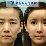 동안<b>성형</b> 종결자 ㅋㅋ