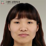 못생긴<b>여자</b> 성형한<b>여자</b> 남자에게 <b>돈</b>써라