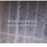 줄기<b>세포</b>가슴성형 1편 - 줄기<b>세포</b> 및 줄기<b>세포</b>가슴성형 이야기