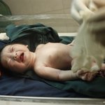 (사진有)이틀동안 세번 출산후 얻은 아들 출산후기~