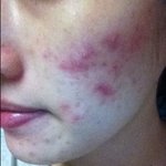 사진有) 지연 닮은 흔 소개합니다.@@@@@@@@@@@@@@@@...