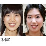 ★<b>치아</b>교정의 중요성★