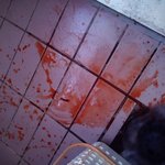 (사진有)※집이 피바다가 됐어요※