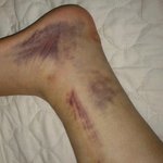 [사진有]엘프가 인스피릿 폭행했어요