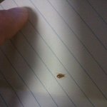 <b>빈대</b>때문에 죽겠습니다. [사진 有]