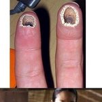 환공포증 <b>진단법</b>