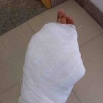 사진有)))))대륙의 의료기술