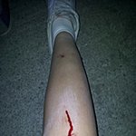 ★★★★친구한테 카톡하다가 하수구에 빠졌어요★★★★