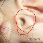 ◆◆◆◆(◆사진有◆)★혐오주의☆) 우리언니의 귀에는 무슨일이.....