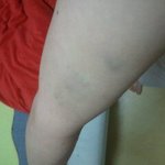 사진첨부)식당<b>종업원</b>한테 맞았어요ㅠ_ㅠ 그런데 그쪽이 오히려 저를...