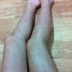 바디슬리밍제품 <b>리</b>*<b>존</b> 부작용 <사진있음>