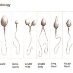 결혼하기전에 여자의 <b>처녀</b>성을 확인하자.