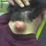 ##########<b>대천</b>에서생긴일(빡침주의)##########