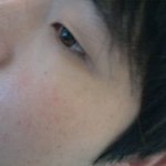 남자<b>눈</b>이여 .. 뒤트임,쌍수하면 <b>눈</b> 좀 커질가요