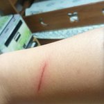 ☆★☆★☆★볼펜으로 <b>칼</b><b>빵</b>흉터 만들기!!!!!!☆★☆★☆★