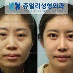 <b>스고이</b>~