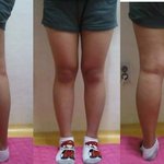 사진有)★[눈베<b>림</b>주의]★뚱뚱녀다리좀봐주세요ㅠ 살빠지면괜찬은라인인지좀봐주세요...