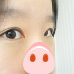 [사진有] 쌍수한人 2011년1월17일에하고난후 최근의 결과.....