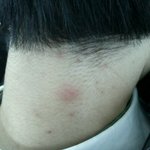 추천안눌렀더니 제...제친구가..  [<b>혐오</b>]