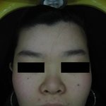 팔자주름 고치러 갔다가 피부 엑스레이 사진찍고 왔어요 ㅜ.ㅜ 심하긴...