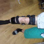 검찰은 의사와 한 <b>솥</b><b>밥</b>인가?고의로 다리 병신을 만든 의사들의 사실...