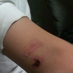 동생이 뺑소니를 당했는데 <b>해결책</b>좀요,,,