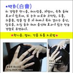 [<b>따봉</b>view]*2탄* 두통이 있다면 여기를 누르세요!!