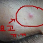 얼굴이랑 팔에 이런거 나는데 왜그러는지 아시는분 ㅠㅠ