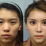 모 성형외과 <b>비포</b>애프터 사진인데 안믿어...