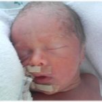 미숙아 1,9kg으로 낳은 우리 아기 이렇게 컸어요.