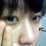 언니들 다클<b>써클</b>없애는방법좀ㅜㅜ사진有