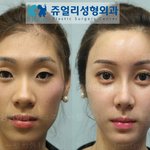 <b>이사진</b>보면서 느끼는점 ㅎㅎ 여자는 얼굴이 생명이구나...