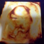 요염한딸 예린이의출산후기♥♥♥