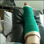 <b>위에</b> 남팬톡 깁스보고 자작이라하는년들 봐라