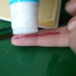 수정+☆★(사진有)간단상처만들기(※노약자임산부어린이등비위약하신<b>분주</b>의)★☆