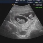 ★★우리집 <b>말썽</b>꾸러기 쌍둥이를 소개합니다★★