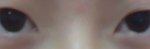 쌍수할까요?????????? 사진有