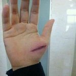 ★★★★(사진有)간단<b>상처</b>만들기 우리도해봤다★★★★