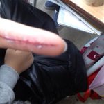 ★☆★☆사진有(스압주위)우리도 상처만들기 해봄★☆★☆