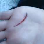 ☆★☆★(사진有)가짜 상처만들기, 우리도 할 수 있다!!☆★☆★