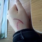 ★★★★(사진有)상처만들기 후기★★★★