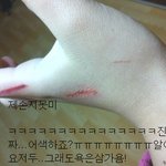 ★★★★★사진有)상처내기★★★★★