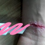 <b>사진</b>有)오늘 <b>손</b>다쳤어요..