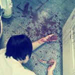 ★★★(사진有)<b>상처</b>? ㄴㄴ우리는 죽었음 ★★★