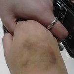 ▶▶▶▶▶[베플인증!]  멍 그리기! 스압주의!◀◀◀◀◀