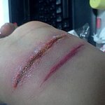 ★★★<b>고퀄</b>상처만들기★★★