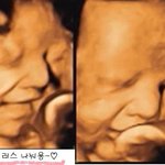 임신 34주..방~~긋 웃는 아기 초음파 사진
