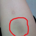 (사진有)디팡잘못타면 <b>이러</b>케된다!!!!