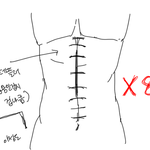 [도와주세요] 저희 아버지를 살려주세요